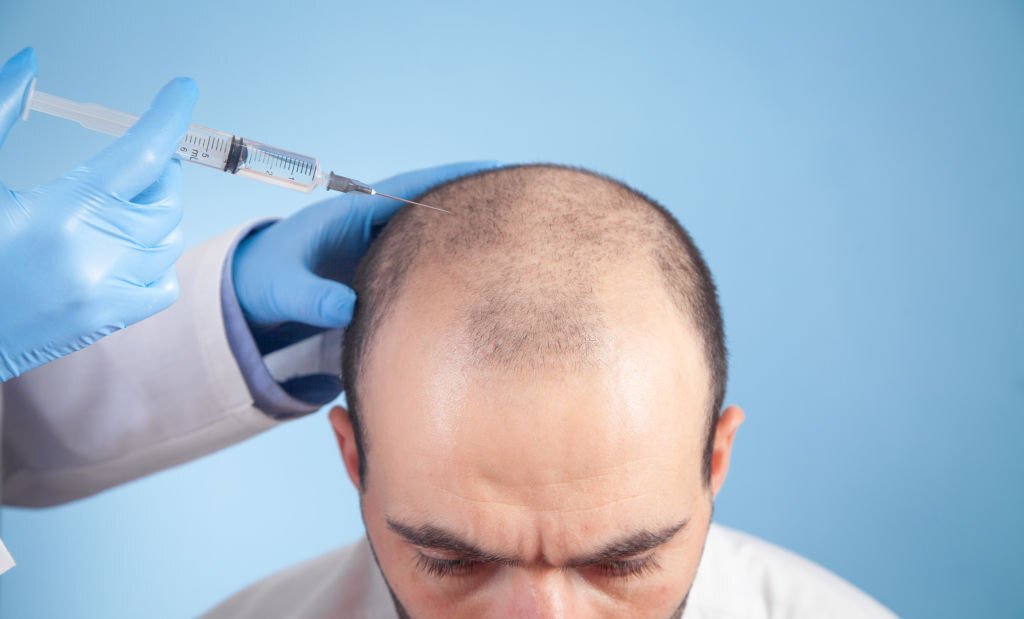 Hair Transplant Bodrum